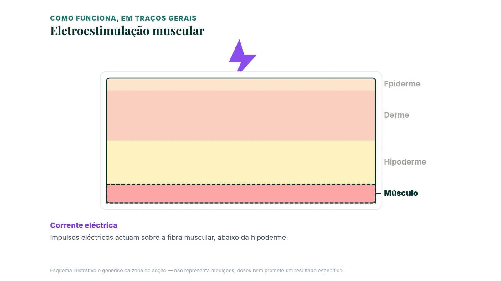 Eletroestimulação: o que pode complementar e como reduzir risco