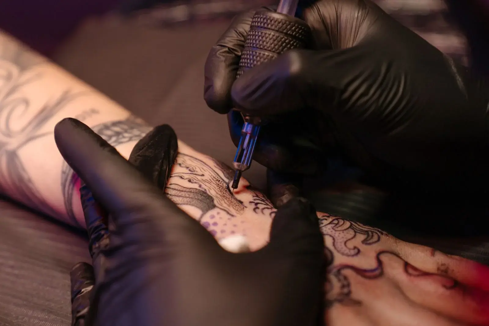 Tatuagens pretas: por que uma cor não torna a remoção previsível